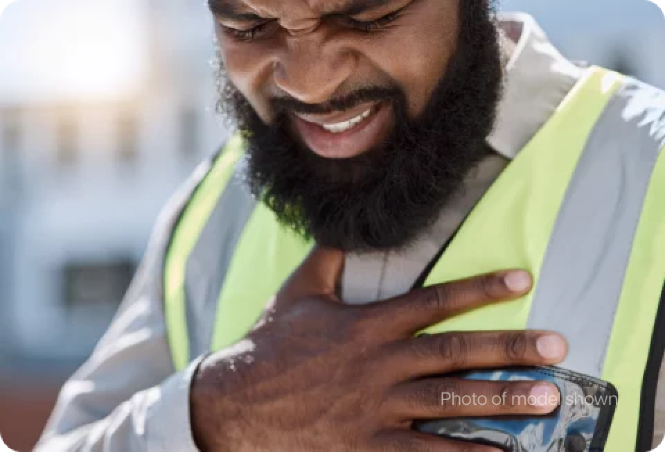 Lipoprotein-associated phospholipase A2 predicted cardiovascular disease in obstructive sleep apnea syndrome