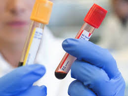 Comprehensive Cardiac Blood Draw